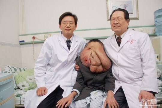 زشت ترین فرد دنیا کیست؟ دل هر کسی به درد می آید + عکس