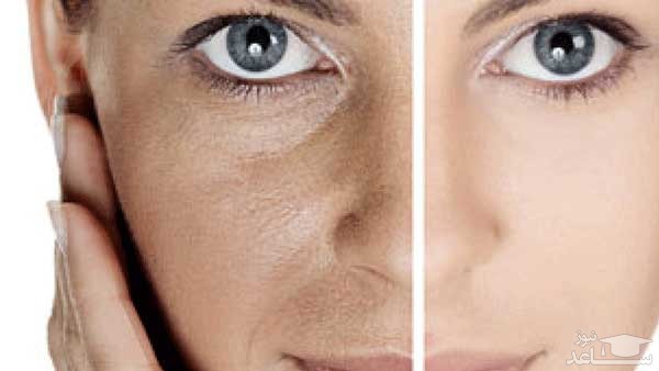 تفاوت پوست صاف و لکه دار