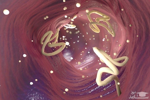 موارد منع مصرف و تداخل دارویی قرص آلبندازول