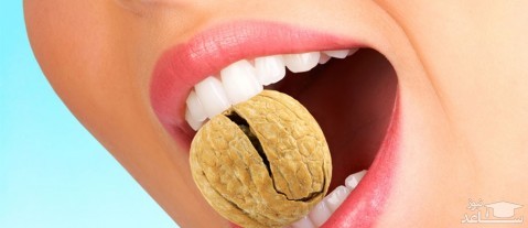 ترک مویی دندان چیست و علل آن