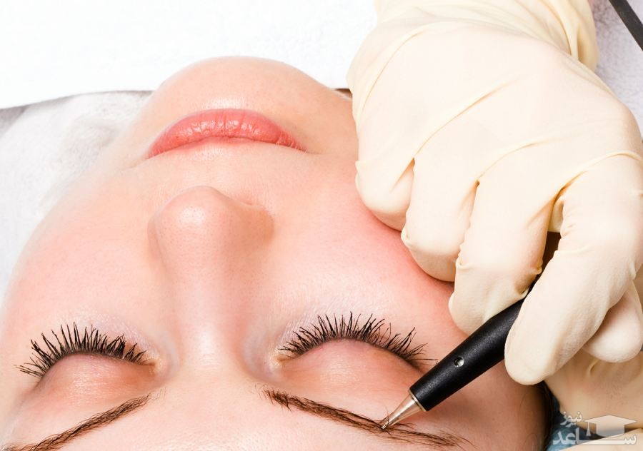 تفاوت میکروبلیدینگ و میکروپیگمنتیشن