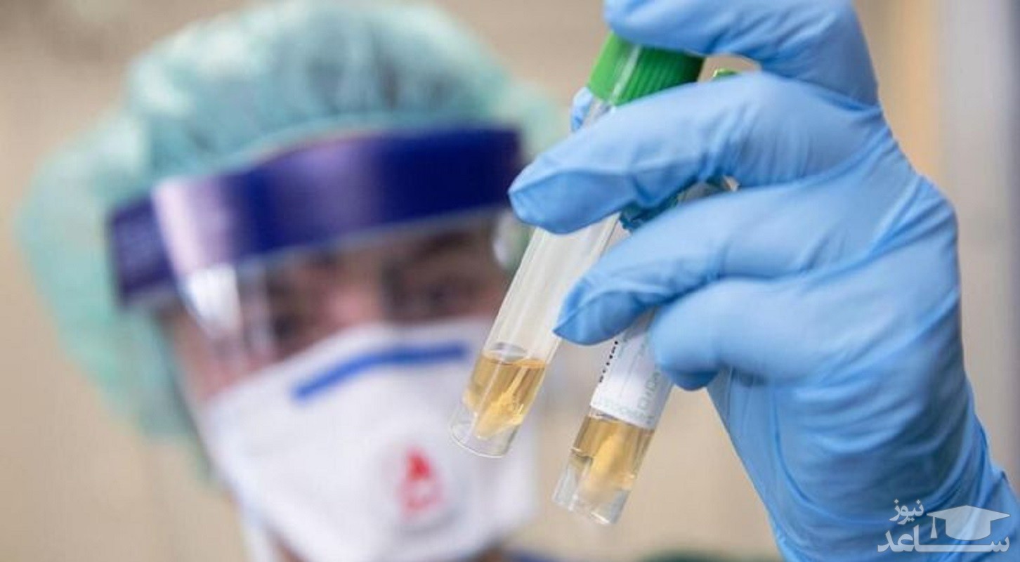 شناسایی روش جدیدی برای کاهش شدت علائم کرونا