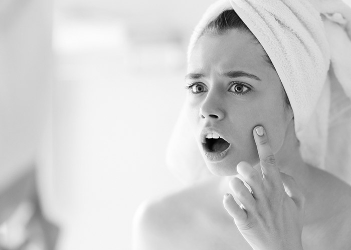 مکمل هایی برای جوش نزدن