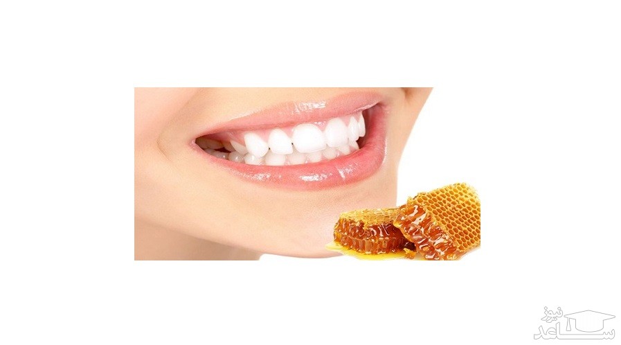 نحوه درمان دندان درد با عسل