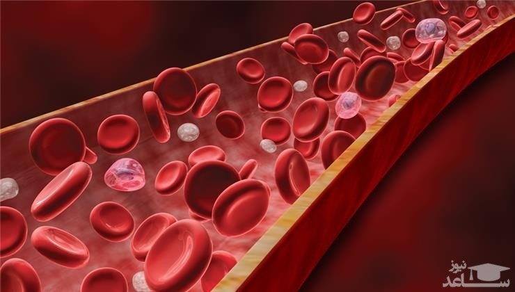 از کجا بدانیم به کم خونی مبتلا هستیم؟