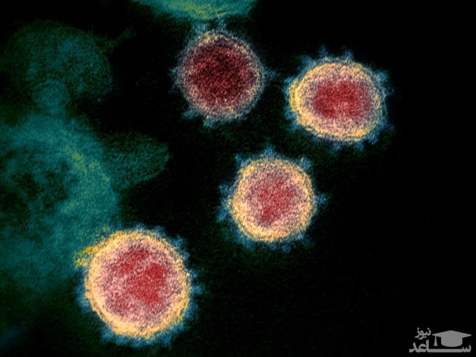 پروتئین‌هایی که مانع ورود کروناویروس به سلول‌های انسان می‌شوند