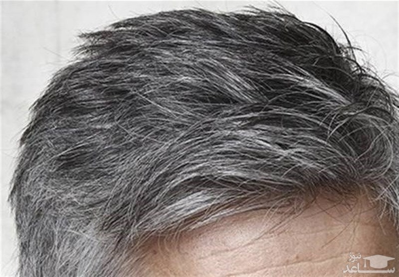 استفاده از روغن شترمرغ در رشد مو