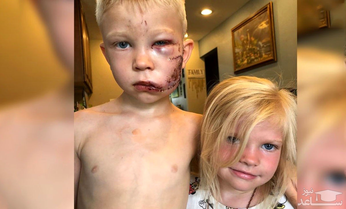 پسر 6 ساله سپر بلای خواهر کوچکترش شد