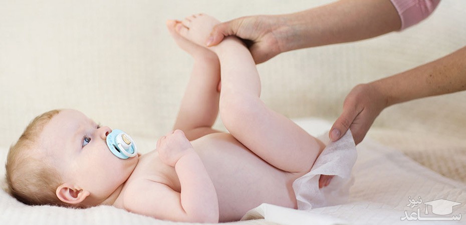 درمان ادرار سوختگی در نوزادان