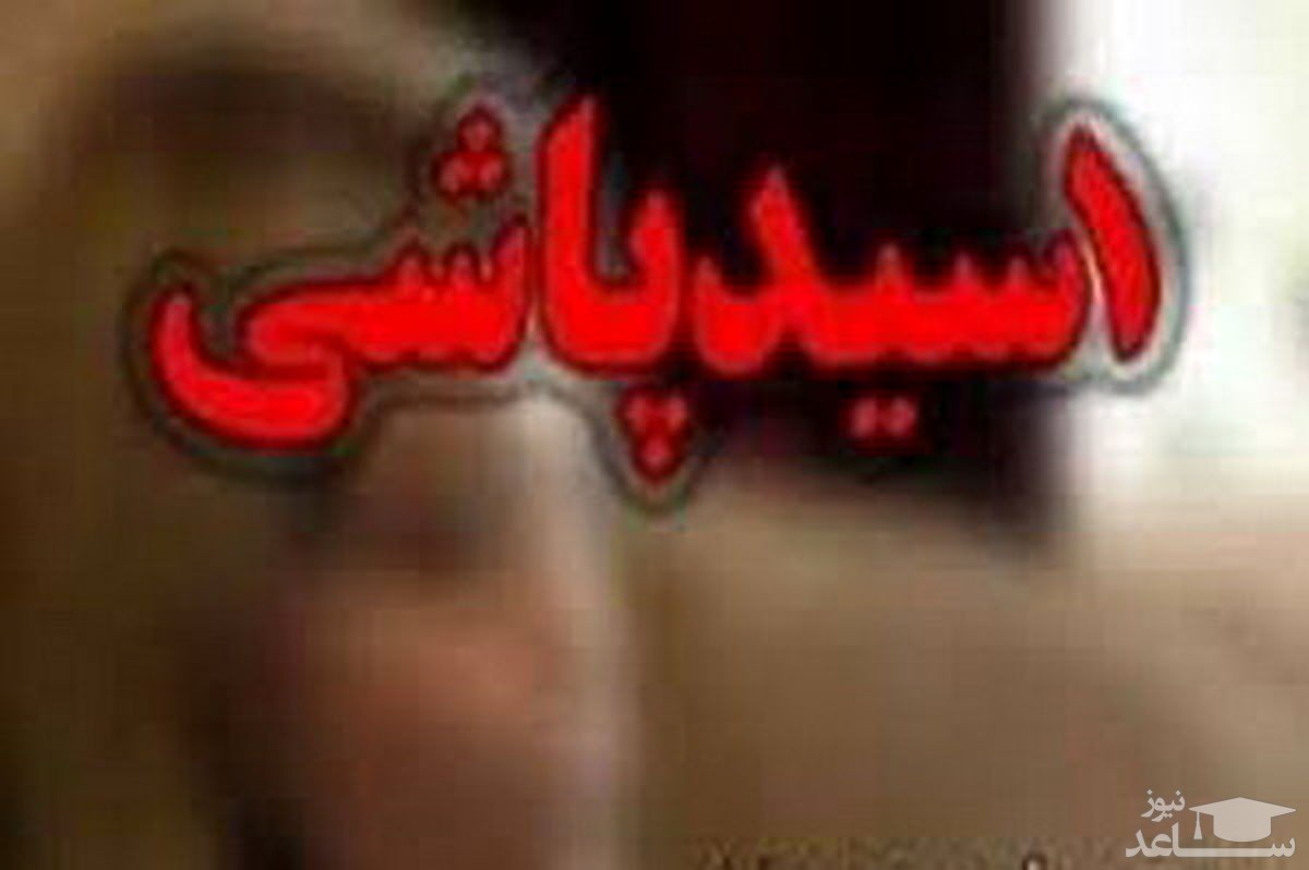 حمله اسیدی به زن موقت توسط مرد شیرازی / مادر و پسر سوختند