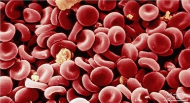 علت کم شدن مقدار پلاکت خون کودکان چیست؟