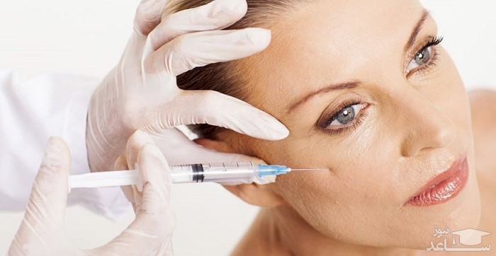 تزریق ژل پروفایلو