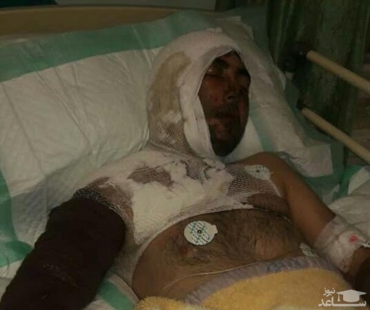 حمله اسیدی پدر در پاسخ به درخواست مالی پسر و عروس!