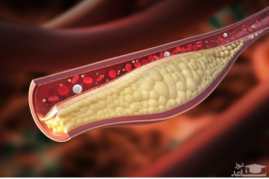میزان مصرف، تاثیرات و مکانیزم اثر داروی فلوواستاتین