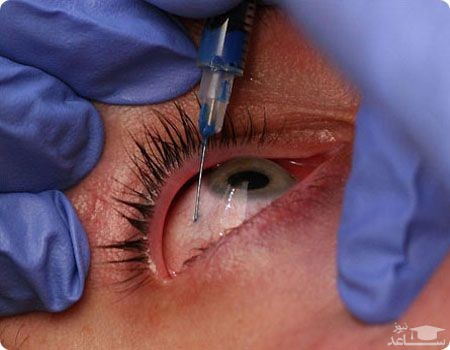 جزئیات جدید از ماجرای مرموز نابینایی ۵٢ نفر با داروی اوستین