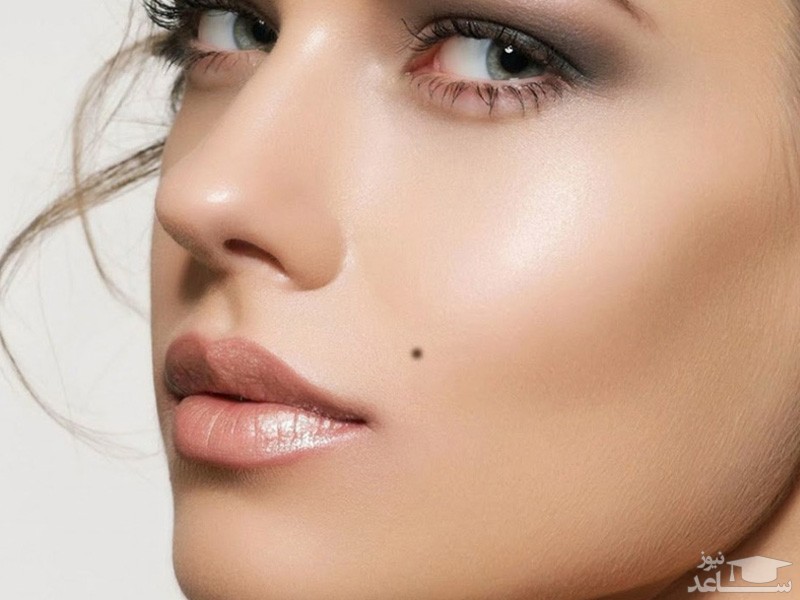 کدام خال را می توان جراحی کرد؟