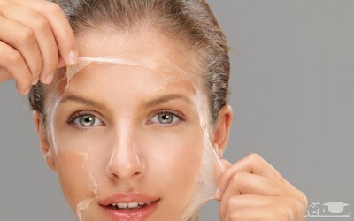 لایه برداری پوست