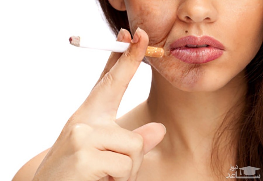 مصرف سیگار چه تاثیری بر زیبایی دارد؟
