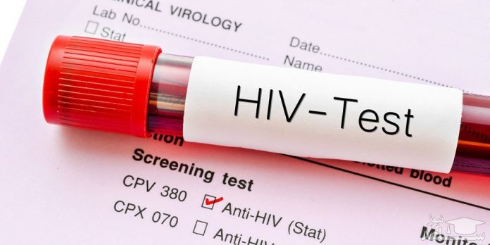 ایدز چه مدت بعد از رابطه جنسی قابل تشخیص است؟
