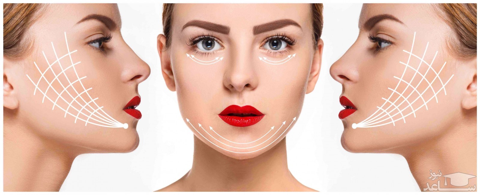 روش آر اف کونتراج برای درمان چین وچروک چگونه کار می کند؟