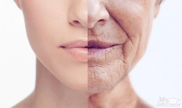 خوراکی هایی که مصرف آن ها باعث پیری پوست می شود