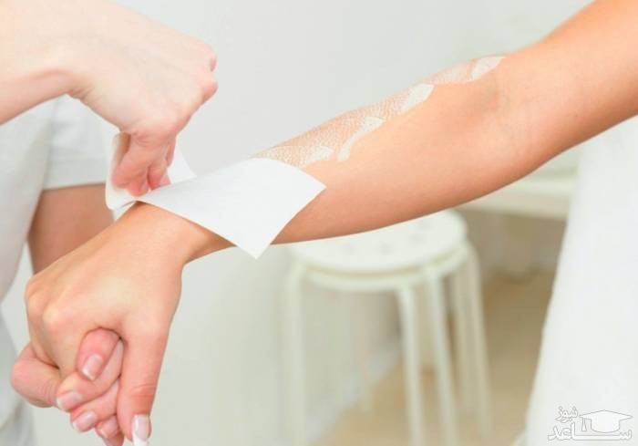 خطرات اپیلاسیون ناحیه تناسلی