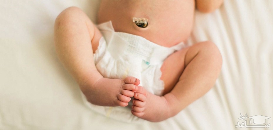 علائم و نشانه های عفونت کردن بند ناف نوزاد