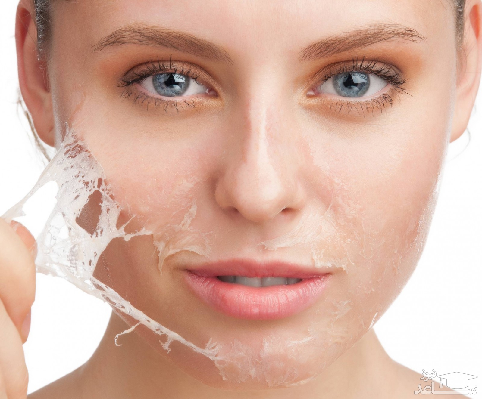 لایه برداری پوست با آنزیم تراپی و مزایای آن