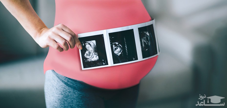 انواع سونوگرافی ها و آزمایش ها در دوران بارداری