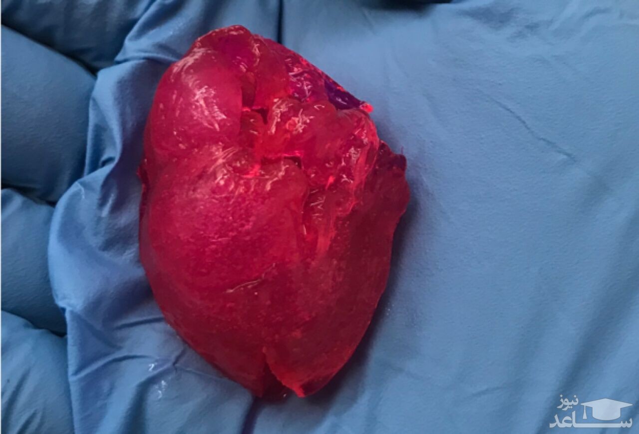 (فیلم) احیای دوباره قلب تا ۲۰ دقیقه پس از متوقف شدن آن