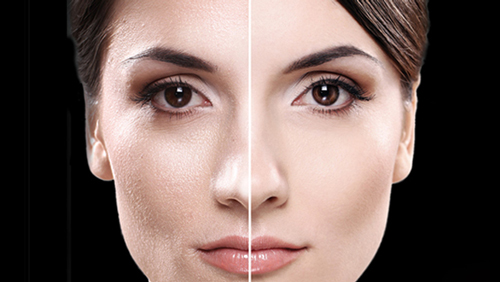 افرادی که پوست چرب دارند بخوانند