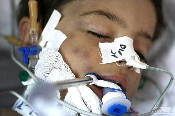 دختر ۴ ساله قربانی کودک‌آزاری