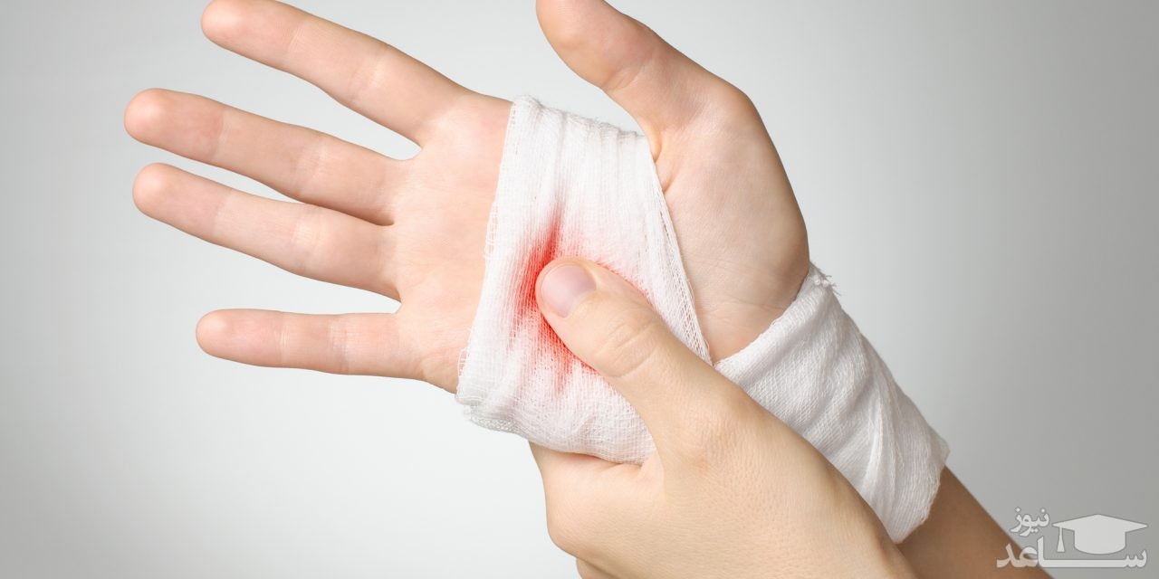 راهکارهای مفید و موثر برای جلوگیری از خونریزی زخم