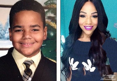 عمل تغییر جنسیت چگونه انجام میشود؟