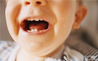 نقش تغذیه بارداری در سلامت دندان های فرزند