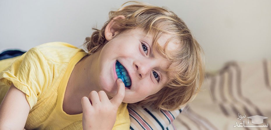 دلایل دندان قروچه در کودکان و روش های درمان