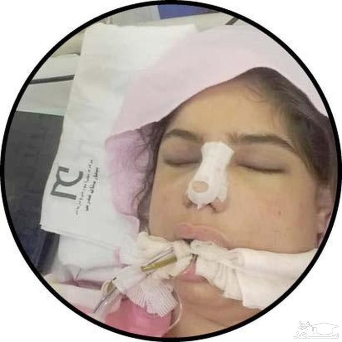 مرگ مرموز سحر اسکندری بعد از عمل بینی در بیمارستان