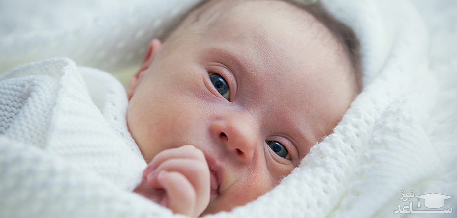دلایل ابتلای نوزاد به سندرم منکس