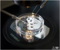 چه زمانی برای درمان نازایی باید اقدام کرد؟