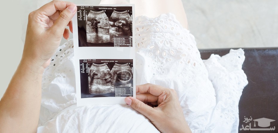 کنترل میزان رشد و وزن جنین با سونوگرافی