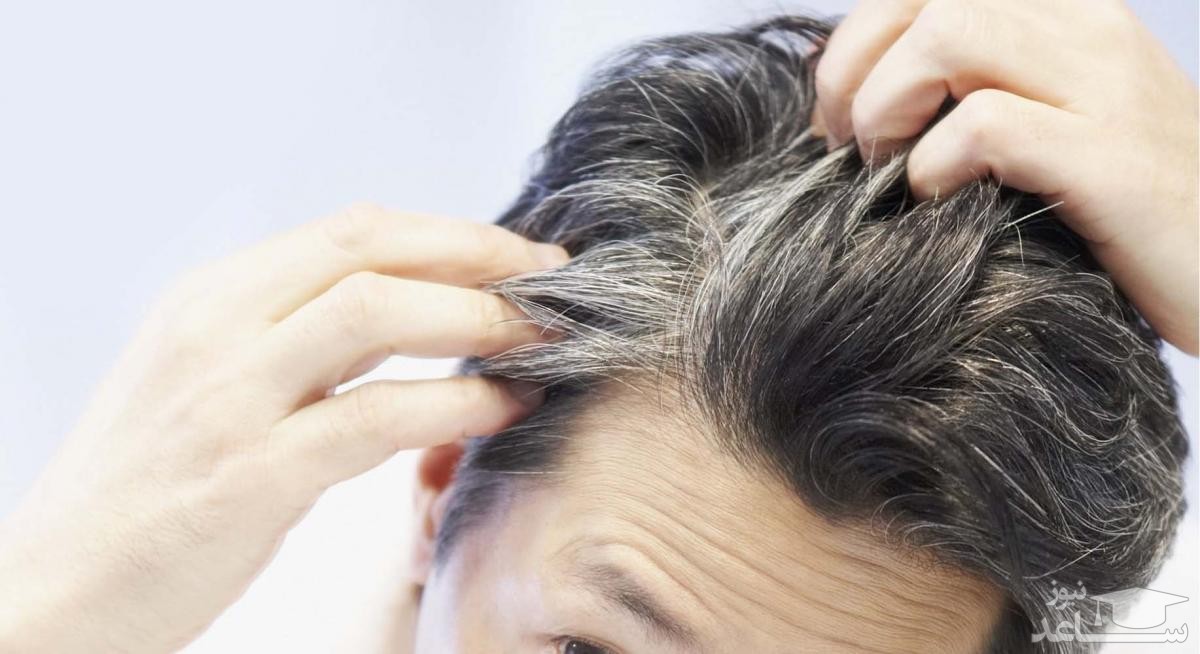 روشهای درمان دارویی ساده برای ریزش موی مردان