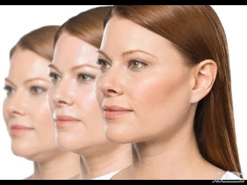 علل ایجاد غبغب و راههای درمان آن