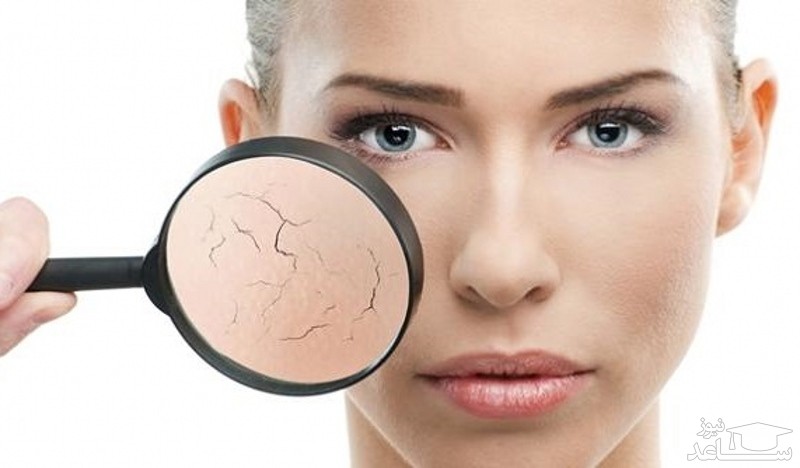 میوه هایی برای درمان خشکی پوست