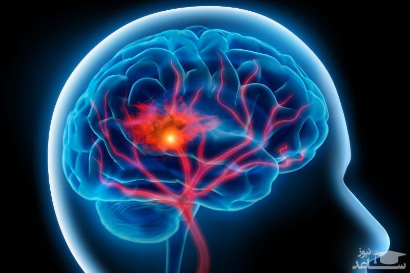 عوامل ایجاد کننده بیماری های عصبی عضلانی