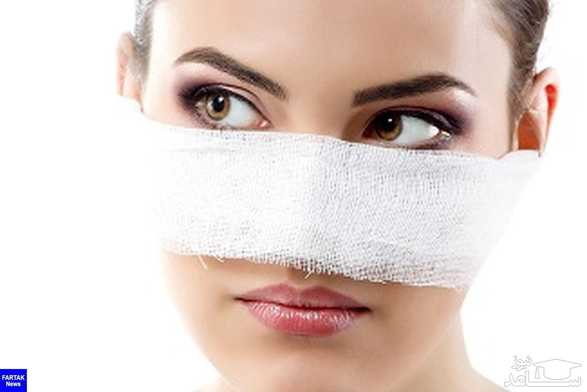 شوک عجیب زن جوان بعد عمل بینی اش