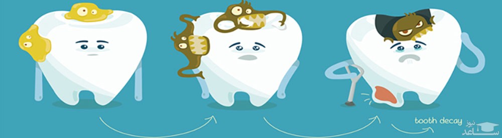 چگونه می‌توان مشکلات دهان و دندان را در دوران بارداری از بین برد؟