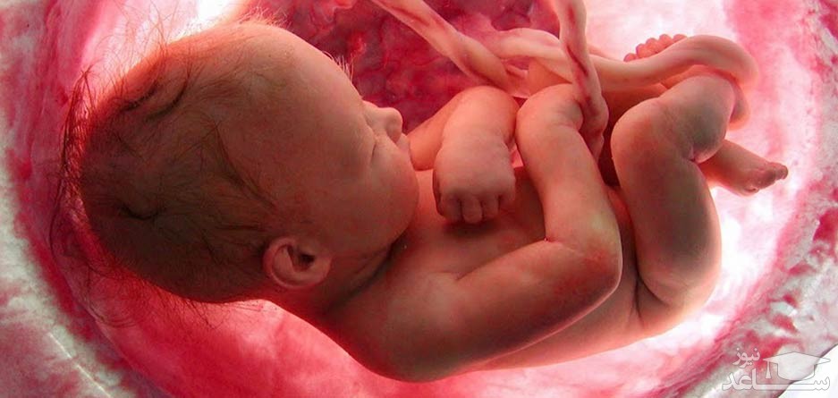 وضعیت سفالیک جنین یعنی چه؟