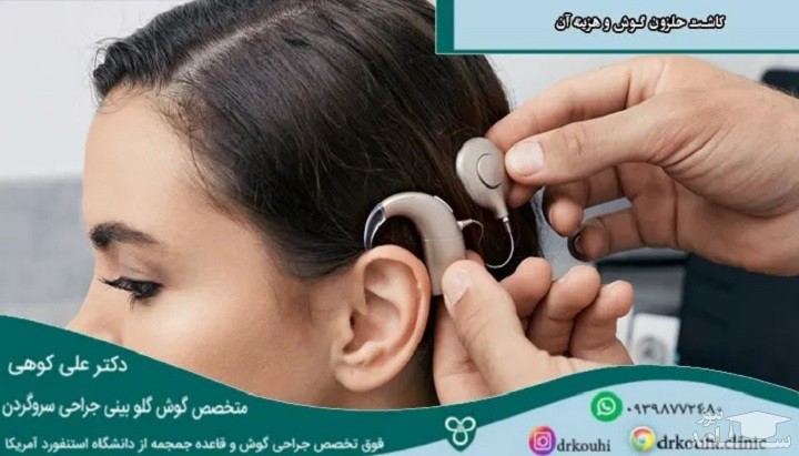 کاشت حلزون گوش چیست و هزینه آن چقدر است؟
