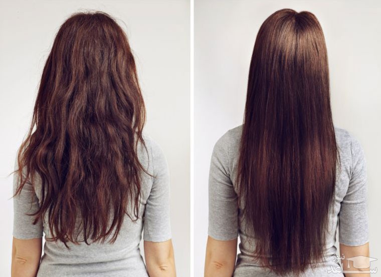 قبل و بعد از ریباندینگ