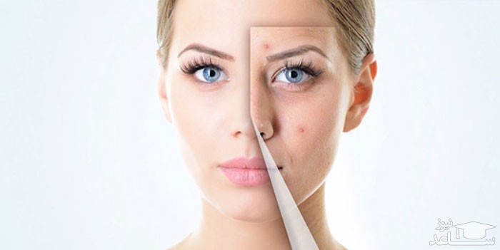 موارد منع مصرف و تداخل دارویی ژل آکدین